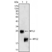 Western blot analysis using MYL3 (1) and MYL2 (2) antibody against rat fetal heart tissue lysate.