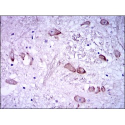 Neurofilament Heavy Polypeptide (NEFH) Antibody