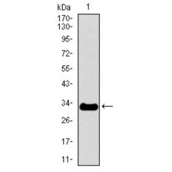 Neurofilament Heavy Polypeptide (NEFH) Antibody