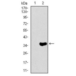 Neurofilament Heavy Polypeptide (NEFH) Antibody