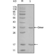 Western blot analysis using EP300 antibody against truncated EP300-His recombinant protein (1).