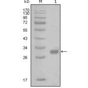 Western blot analysis using PAR1 antibody against truncated GST-PAR1 recombinant protein (1).