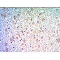 Kelch-Like Protein 21 (KLHL21) Antibody