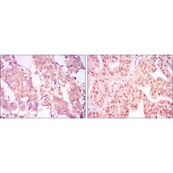 Coactivator-Associated Arginine Methyltransferase 1 (CARM1) Antibody