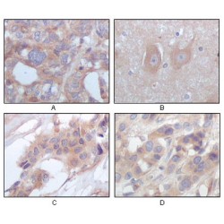 Tyrosine-Protein Kinase STYK1 (STYK1) Antibody