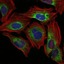 Protein Phosphatase 2A Activator, Regulatory Subunit 4 (PPP2R4) Antibody