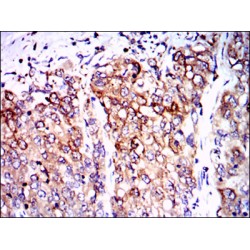 Protein Phosphatase 2A Activator, Regulatory Subunit 4 (PPP2R4) Antibody