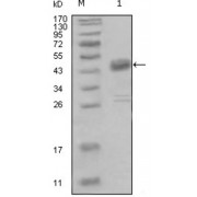 Western blot analysis using DDR1 antibody against truncated MBP-DDR1 recombinant protein (1).