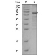 Western blot analysis using MSH6 antibody against truncated MSH6 recombinant protein.