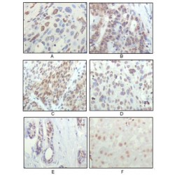 90 kDa Ribosomal Protein S6 Kinase 1 (RPS6KA1) Antibody