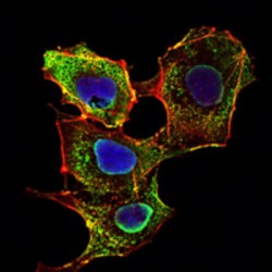 Mothers Against Decapentaplegic Homolog 3 (SMAD3) Antibody