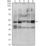 Western blot analysis using SMAD3 antibody against A549 (1), Hela (2), Jurkat (3), PC-2 (4) and NIH/3T3 (5) cell lysate.