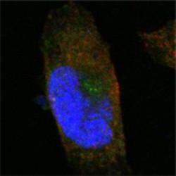 Sortilin Related Receptor (SORL1) Antibody