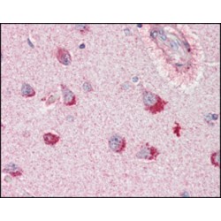 Sortilin Related Receptor (SORL1) Antibody