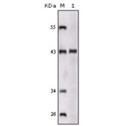 Western blot analysis using SORL1 antibody against truncated SORL1 recombinant protein.