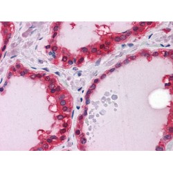 Hsc70-Interacting Protein (ST13) Antibody