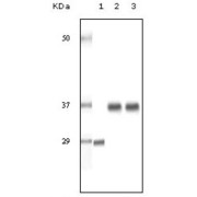 Western blot analysis using SRA antibody against truncated SRA recombinant protein (1), human ovary cancer tissue lysate (2) and A431 cell lysate (3).