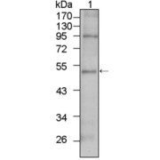 Western blot analysis using TBX5 antibody against HepG2 cell lysate (1).