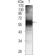 Western blot analysis using TEC antibody against TEC (aa90-240) -hIgGFc transfected HEK293 cell lysate (1).