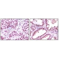 Lysine-Specific Histone Demethylase 1A (LSD1) Antibody