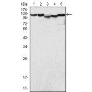 Western blot analysis using LSD1 antibody against COS (1), Hela (2), NIH/3T3 (3), A549 (4) and Jurkat (5) cell lysate.