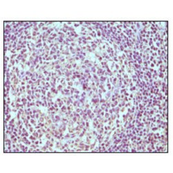 B-Lymphocyte Antigen CD19 (CD19) Antibody