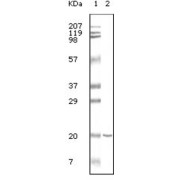 Western blot analysis using CD19 antibody against CD19 recombinant protein.