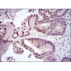 Proto-Oncogene C-Fos (FOS) Antibody