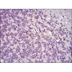 Proto-Oncogene C-Fos (FOS) Antibody