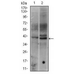 Proto-Oncogene C-Fos (FOS) Antibody