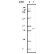 Western blot analysis using HPTR antibody against truncated HPRT recombinant protein.