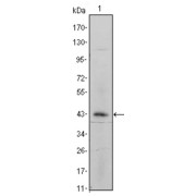 Western blot analysis using ITGA5 antibody against ITGA5-hIgGFc transfected HEK293 cell lysate.