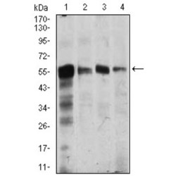 Calcium/calmodulin Dependent Protein Kinase IV (CAMK4) Antibody