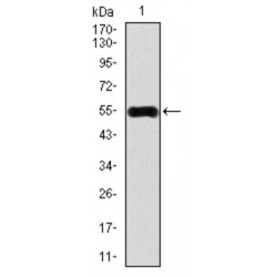 Calcium/calmodulin Dependent Protein Kinase IV (CAMK4) Antibody