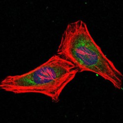 Proteasome Subunit Beta Type 8 (PSMB8) Antibody