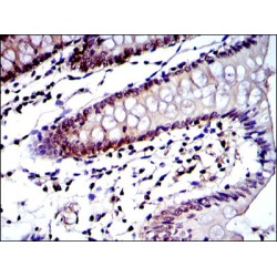 Proteasome Subunit Beta Type 8 (PSMB8) Antibody