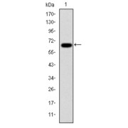 Western blot analysis using PSMB8 antibody against human PSMB8 (AA: 1-272) recombinant protein. (Expected MW is 55.2 kDa).