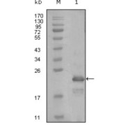 Western blot analysis using HAND1 antibody against truncated Trx-HAND1 recombinant protein (1).