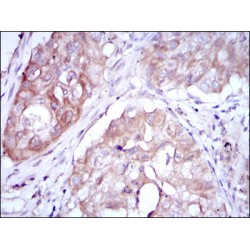 Methylenetetrahydrofolate Reductase (MTHFR) Antibody