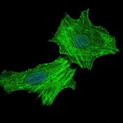 Argininosuccinate Synthase (ASS1) Antibody