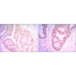 THAP Domain Containing 11 (THAP11) Antibody