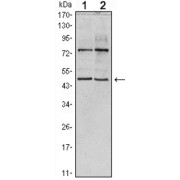 Western blot analysis using THAP11 antibody against Hela (1) and NTERA-2 (2) cell lysate.