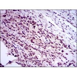 E2F Transcription Factor 1 (E2F1) Antibody