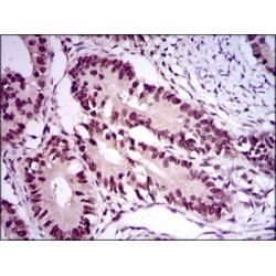 E2F Transcription Factor 1 (E2F1) Antibody