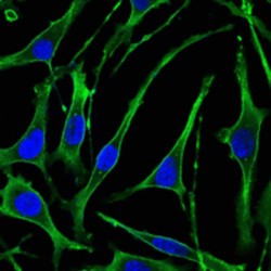 Parathyroid Hormone Receptor 1 (PTH1R) Antibody