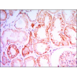 Parathyroid Hormone Receptor 1 (PTH1R) Antibody