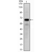 Western blot analysis using PTH1R antibody against PTH1R (AA: 27-188) -hIgGFc transfected HEK293 cell lysate.