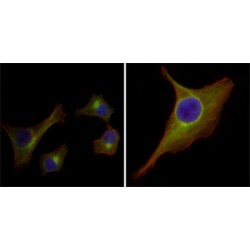 Keratin 15 (KRT15) Antibody