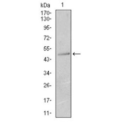 Keratin 13 (KRT13) Antibody