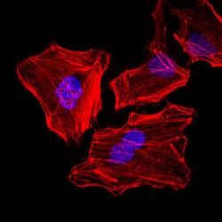 Keratin, Type II Cytoskeletal 5 (KRT5) Antibody